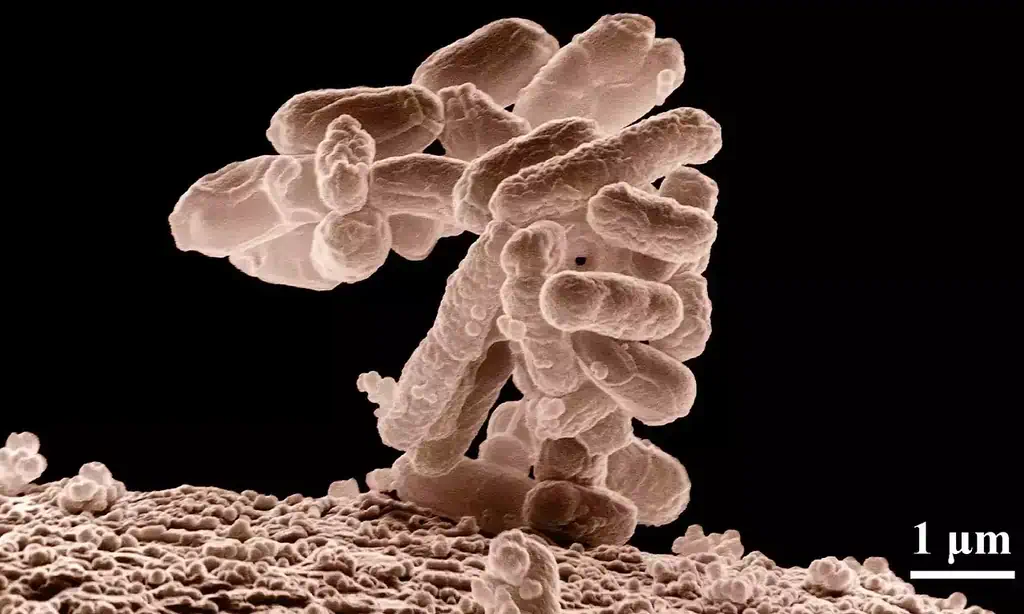 Batteri causano cistite batterica